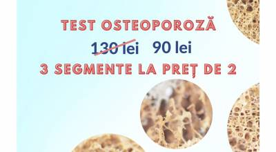 Ziua Mondială a Osteoporozei (DEXA – 3 segmente la 90 de lei)